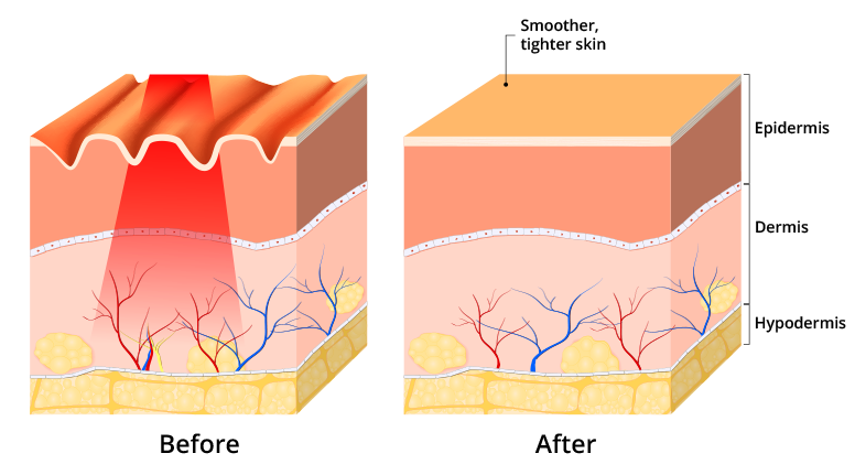 WHAT LED TECHNOLOGY DOES FOR YOUR SKIN – Fortoire